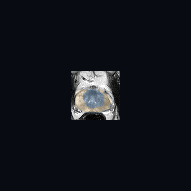 Demo: AI-segmented anatomy MRI preview